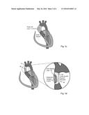 ELECTROACTIVE ACTUATORS diagram and image