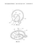 Systems for Isolation of a Needle-based Infusion Set diagram and image