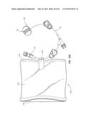 Systems for Isolation of a Needle-based Infusion Set diagram and image