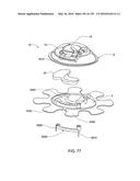 FLUID DELIVERY SYSTEMS AND METHODS diagram and image