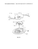 FLUID DELIVERY SYSTEMS AND METHODS diagram and image