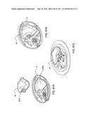 FLUID DELIVERY SYSTEMS AND METHODS diagram and image