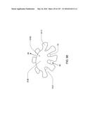 FLUID DELIVERY SYSTEMS AND METHODS diagram and image