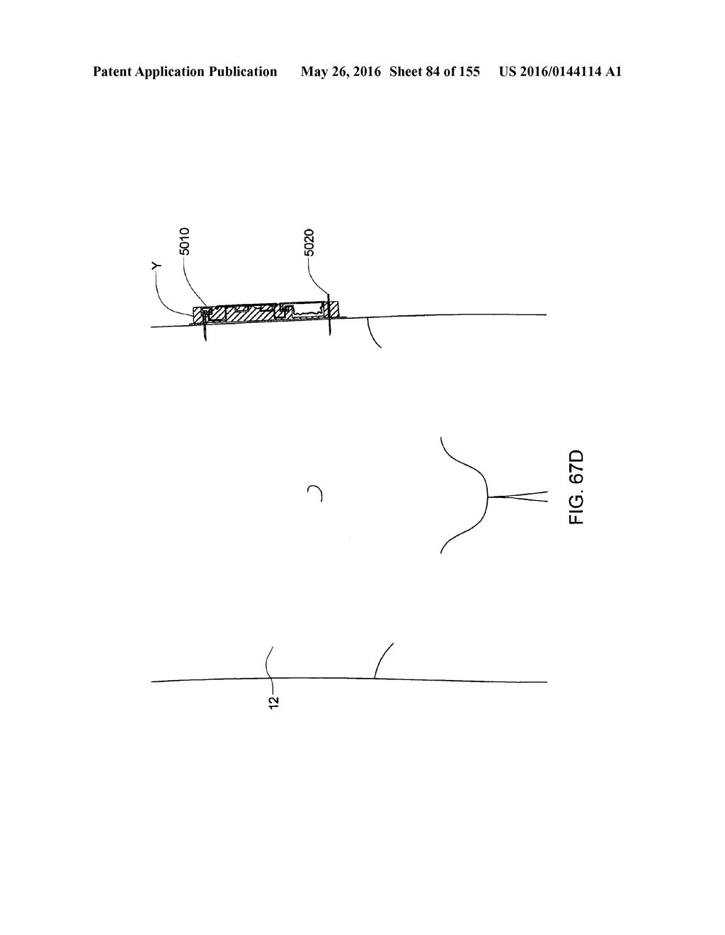 FLUID DELIVERY SYSTEMS AND METHODS - diagram, schematic, and image 85