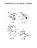 HEADGEAR ASSEMBLIES AND INTERFACE ASSEMBLIES WITH HEADGEAR diagram and image