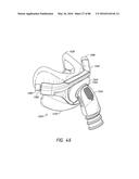 HEADGEAR ASSEMBLIES AND INTERFACE ASSEMBLIES WITH HEADGEAR diagram and image