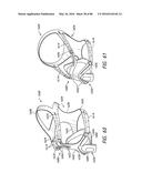 HEADGEAR ASSEMBLIES AND INTERFACE ASSEMBLIES WITH HEADGEAR diagram and image