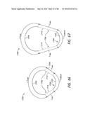 HEADGEAR ASSEMBLIES AND INTERFACE ASSEMBLIES WITH HEADGEAR diagram and image