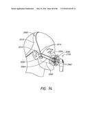 HEADGEAR ASSEMBLIES AND INTERFACE ASSEMBLIES WITH HEADGEAR diagram and image