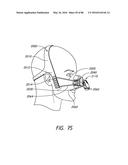 HEADGEAR ASSEMBLIES AND INTERFACE ASSEMBLIES WITH HEADGEAR diagram and image