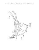 HEADGEAR ASSEMBLIES AND INTERFACE ASSEMBLIES WITH HEADGEAR diagram and image