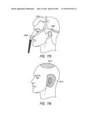 HEADGEAR ASSEMBLIES AND INTERFACE ASSEMBLIES WITH HEADGEAR diagram and image