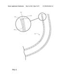 IMPLANTABLE MEDICAL LEAD WITH PROTECTIVE TUBING ELEMENT diagram and image