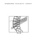 DISTURBING MAGNETIC RESONANCE IMAGING (MRI) IMAGES USING IMPLANTABLE     MEDICAL DEVICE diagram and image