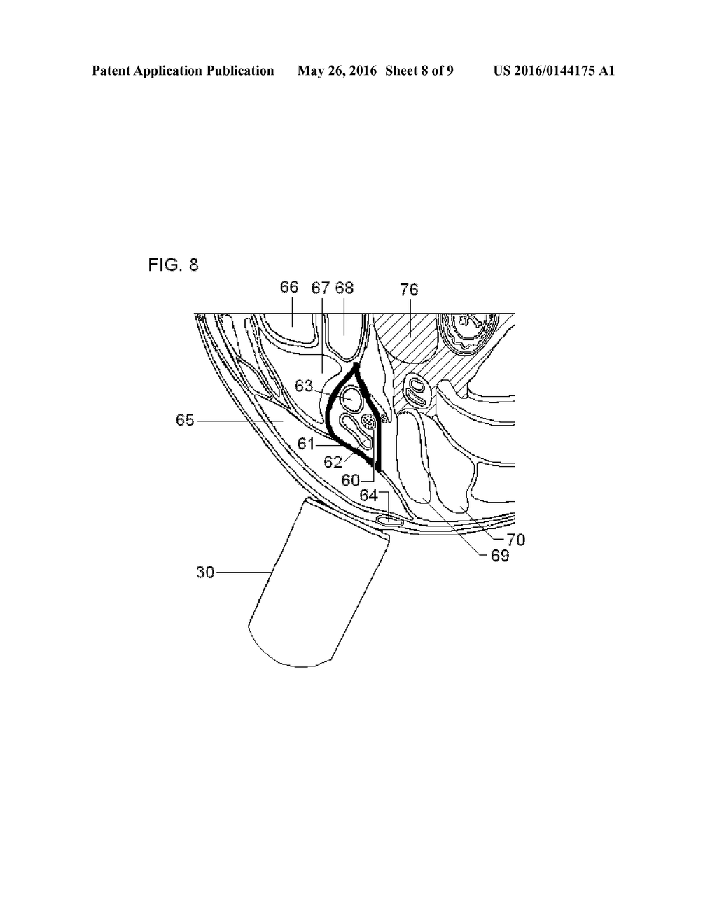 MEDICAL SELF-TREATMENT USING NON-INVASIVE VAGUS NERVE STIMULATION - diagram, schematic, and image 09