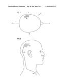 NEURAL BLOCKING THERAPY diagram and image