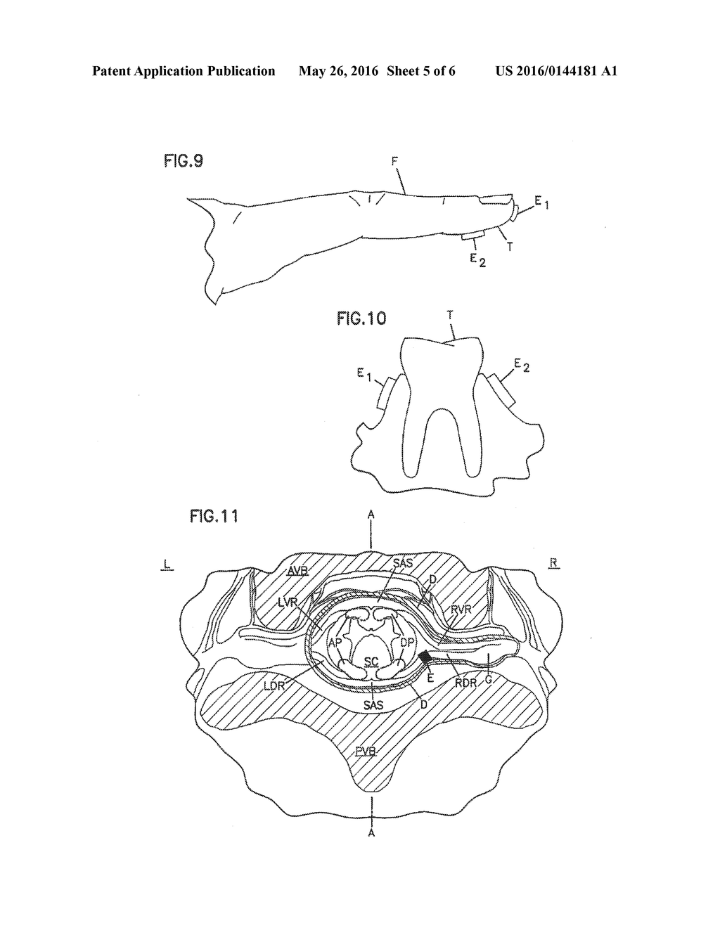 NEURAL BLOCKING THERAPY - diagram, schematic, and image 06