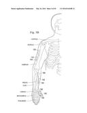 NEUROSTIMULATOR CONFIGURED TO SENSE EVOKED POTENTIALS IN PERIPHERAL NERVES diagram and image