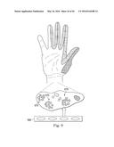 NEUROSTIMULATOR CONFIGURED TO SENSE EVOKED POTENTIALS IN PERIPHERAL NERVES diagram and image