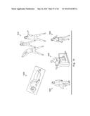 NEUROSTIMULATOR CONFIGURED TO SENSE EVOKED POTENTIALS IN PERIPHERAL NERVES diagram and image