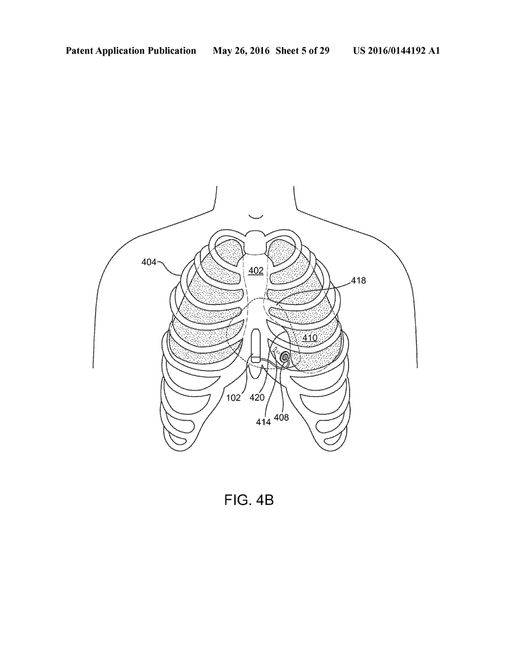 CARDIAC PACING SENSING AND CONTROL - diagram, schematic, and image 06