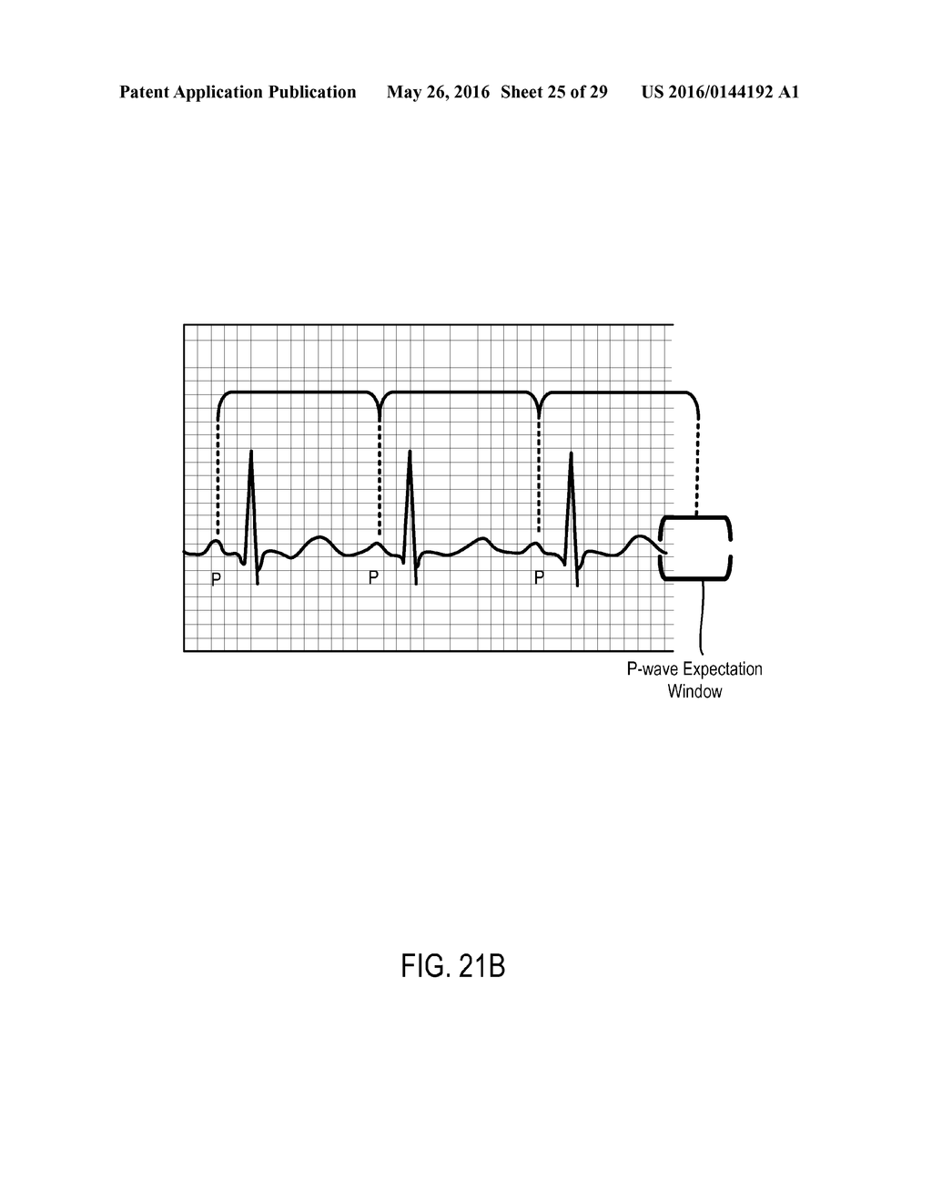 CARDIAC PACING SENSING AND CONTROL - diagram, schematic, and image 26