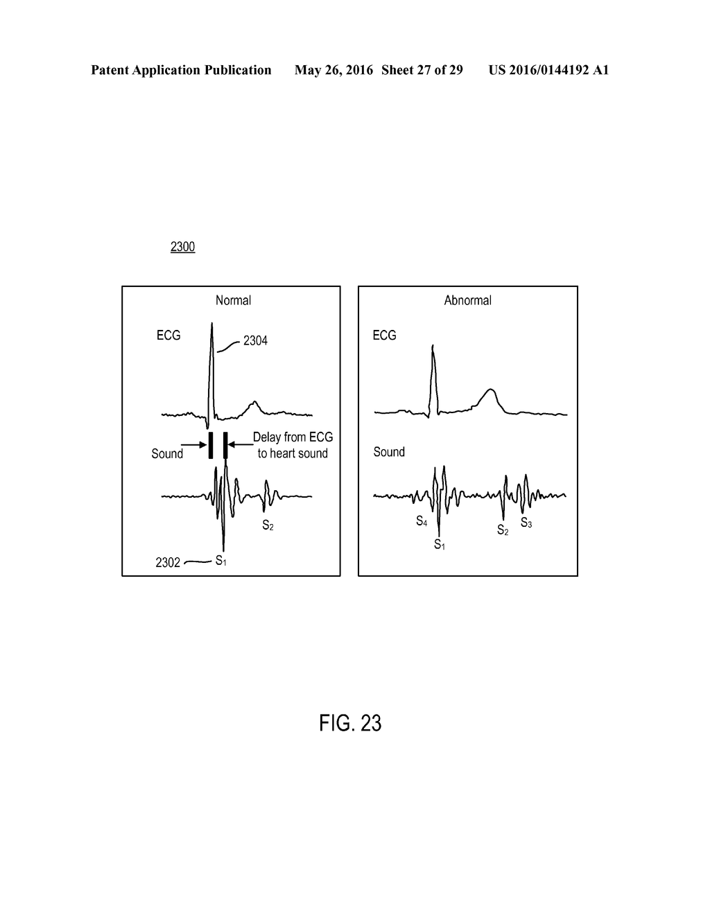 CARDIAC PACING SENSING AND CONTROL - diagram, schematic, and image 28