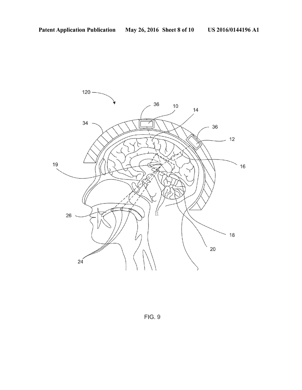 NON-INVASIVE IN VIVO DEEP NERVE CELL STIMULATION SYSTEM AND METHOD - diagram, schematic, and image 09