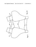 Bicycle Seat for Protecting Ischial Tuberosities diagram and image