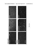 NUCLEAR TRANSPORT MODULATORS AND USES THEREOF diagram and image