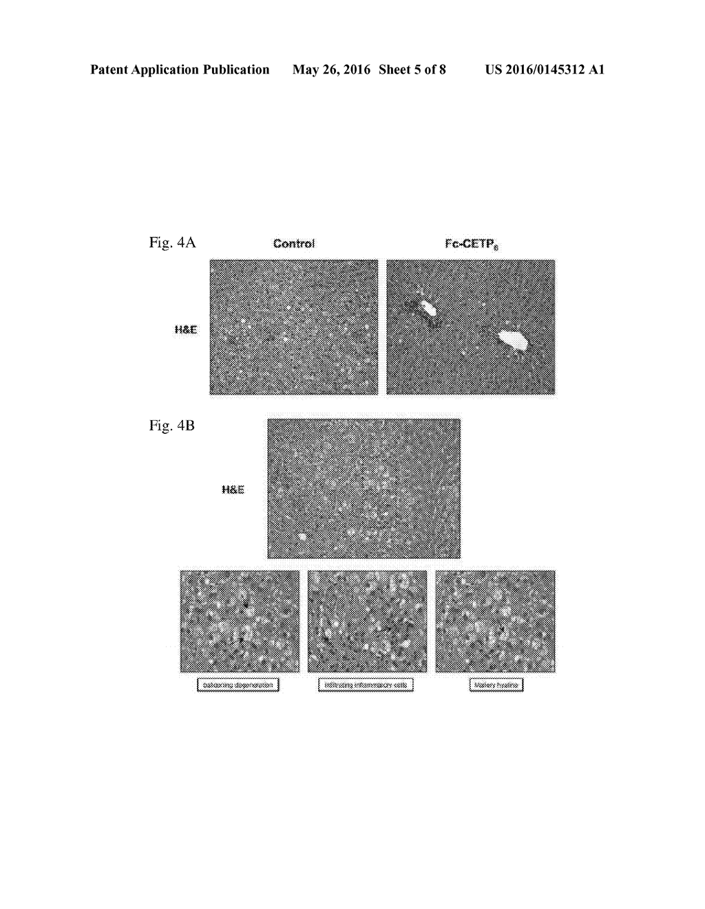 CETP ANTIGENIC PEPTIDE AND FUSION PROTEIN AND THEIR COMPOSITION AND     APPLICATIONS - diagram, schematic, and image 06