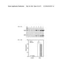 Anti-Prostate Cancer Antibodies and Methods of Detection and Treatment of     Prostate Cancer diagram and image