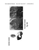 ANTIBODIES AGAINST CD73 AND USES THEREOF diagram and image