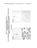 Differentiated Pluripotent Stem Cell Progeny Depleted of Extraneous     Phenotypes diagram and image