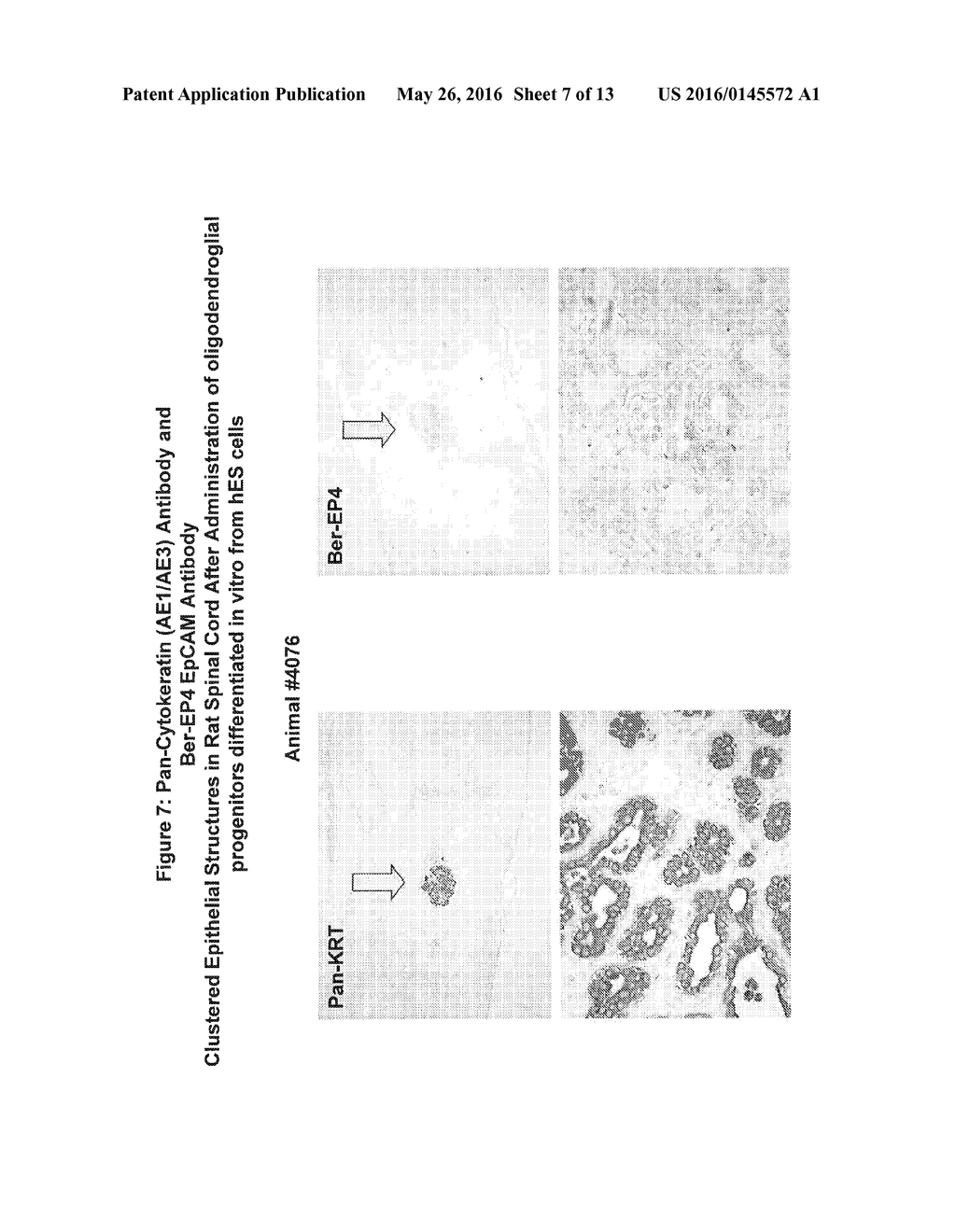 Differentiated Pluripotent Stem Cell Progeny Depleted of Extraneous     Phenotypes - diagram, schematic, and image 08