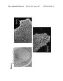 GENERATION OF INDUCED PLURIPOTENT STEM CELLS FROM NORMAL HUMAN MAMMARY     EPITHELIAL CELLS diagram and image