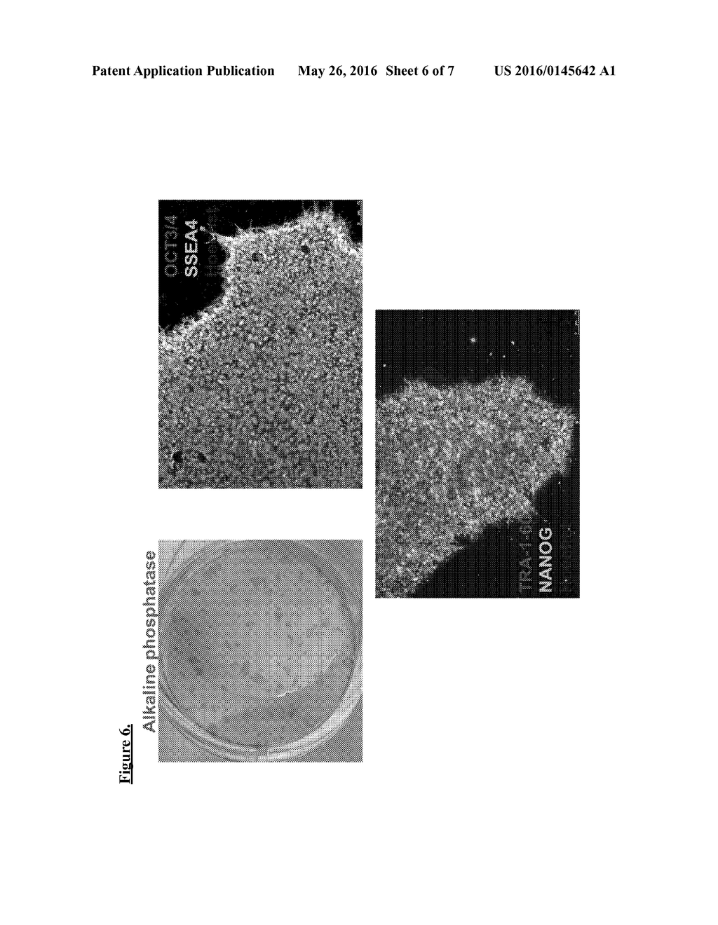 GENERATION OF INDUCED PLURIPOTENT STEM CELLS FROM NORMAL HUMAN MAMMARY     EPITHELIAL CELLS - diagram, schematic, and image 07