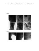 TITANIUM-ALUMINUM-BASED ALLOY diagram and image