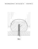 Decorative Toilet Bolt Cover diagram and image