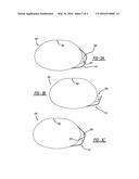 MUFFLER SHIELD AND MUFFLER ASSEMBLY EMPLOYING THE SAME diagram and image