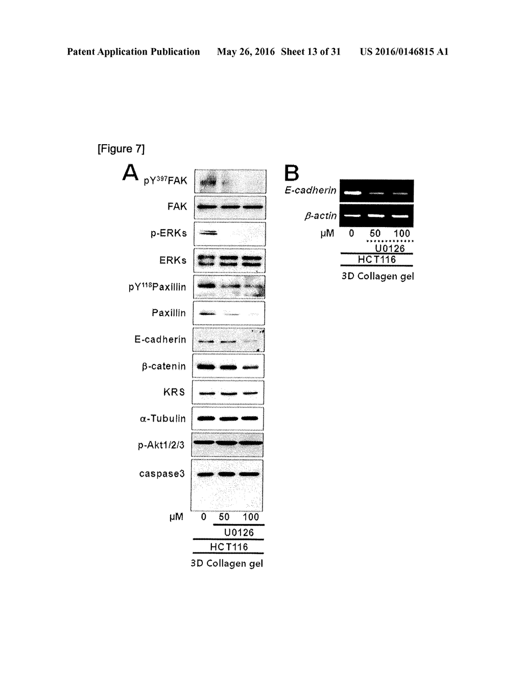 METHOD FOR SCREEING CANCER METASTASIS INHIBITOR USING CULTURE OF CELLS OR     SPHEROIDICALLY AGGREGATED CELLS IN WHICH LYSYL-TRNA SYNTHETASE IS     REGULATED TO BE EXPRESSED OR UNEXPRESSED - diagram, schematic, and image 14