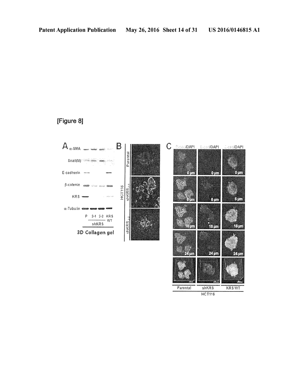 METHOD FOR SCREEING CANCER METASTASIS INHIBITOR USING CULTURE OF CELLS OR     SPHEROIDICALLY AGGREGATED CELLS IN WHICH LYSYL-TRNA SYNTHETASE IS     REGULATED TO BE EXPRESSED OR UNEXPRESSED - diagram, schematic, and image 15