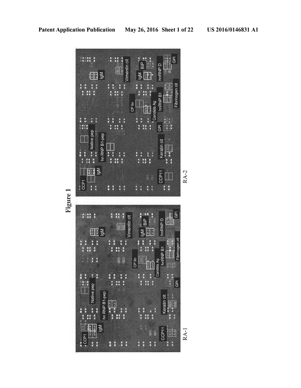 Antibody and Cytokine Biomarker Profiling for Determination of Patient     Responsiveness - diagram, schematic, and image 02