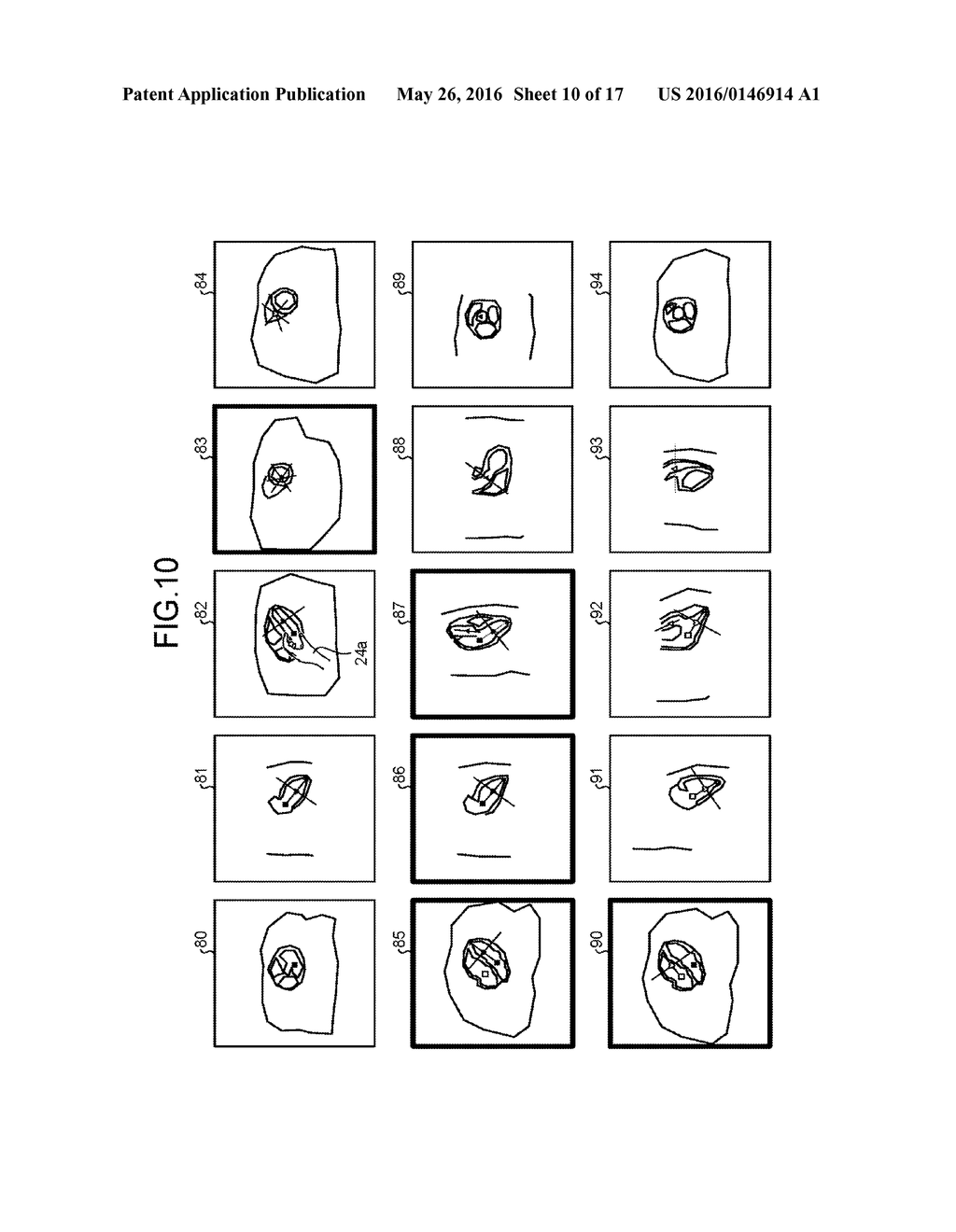 MAGNETIC RESONANCE IMAGING APPARATUS AND MEDICAL IMAGE PROCESSING METHOD - diagram, schematic, and image 11