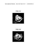 MAGNETIC RESONANCE IMAGING APPARATUS AND MEDICAL IMAGE PROCESSING METHOD diagram and image