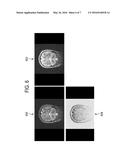 CORRECTED MAGNETIC RESONANCE IMAGING USING COIL SENSITIVITIES diagram and image