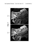 CORRECTED MAGNETIC RESONANCE IMAGING USING COIL SENSITIVITIES diagram and image