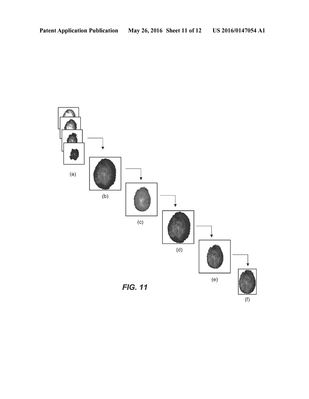 COMPUTATIONAL MICROSCOPY THROUGH A CANNULA - diagram, schematic, and image 12