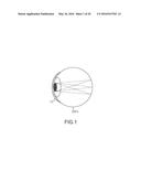 DETECTION APPARATUS AND METHOD diagram and image