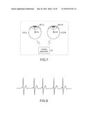 DETECTION APPARATUS AND METHOD diagram and image